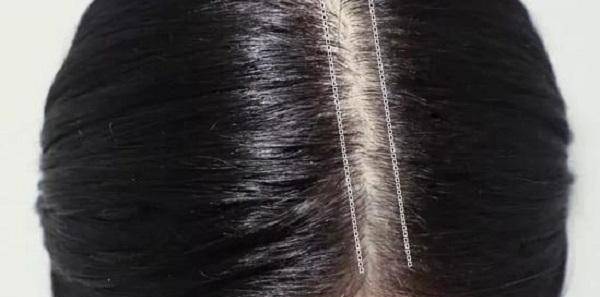 头皮|头发干枯毛躁，头屑，出油多怎么办？养发护发我有妙招