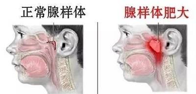 专科医院|武汉民生耳鼻喉医院 看病专业技术先进就医有保障值得信赖