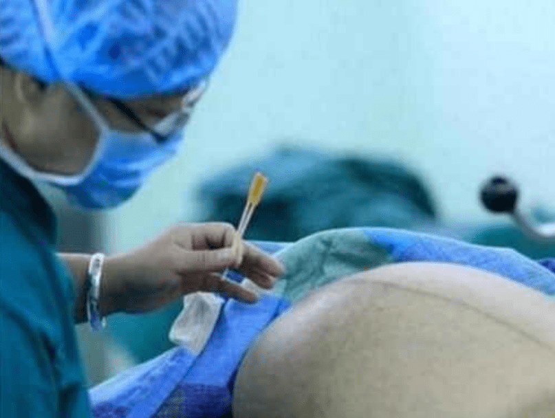 因为|第一次剖腹产和第二次剖腹产，到底有啥区别？疼痛度不同只是基础