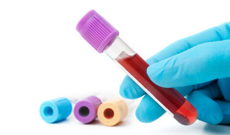 症状|肾不好,能吃水果吗?听一句劝:这些食物别贪吃,肾会感谢你