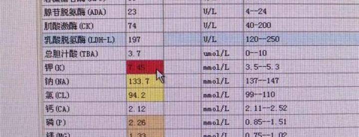 症状|肾不好,能吃水果吗?听一句劝:这些食物别贪吃,肾会感谢你
