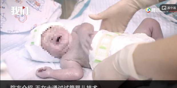 兄弟|双胞胎兄弟竟可以相差10岁？医生通过冷冻10年胚胎成功“复苏”