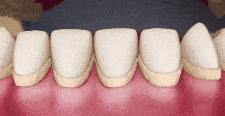 c93b8d65324a4d79a4e11c2946654954.gif
