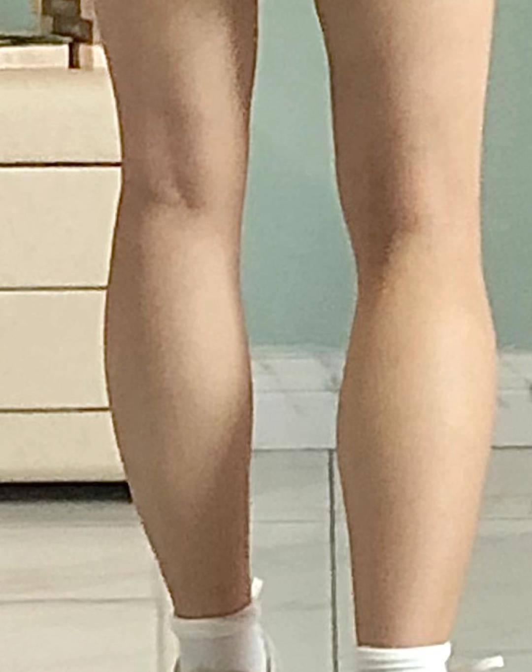 大腿|女星沈月从土肥圆到日系美少女，她到底do了哪里？