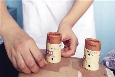 西安市|丨媒体报道丨火罐“拔出”中医热