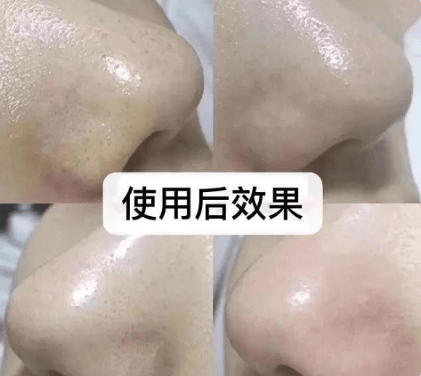脸部|赵丽颖近照曝光，离开了十级精修后，皮肤状态过于真实了！