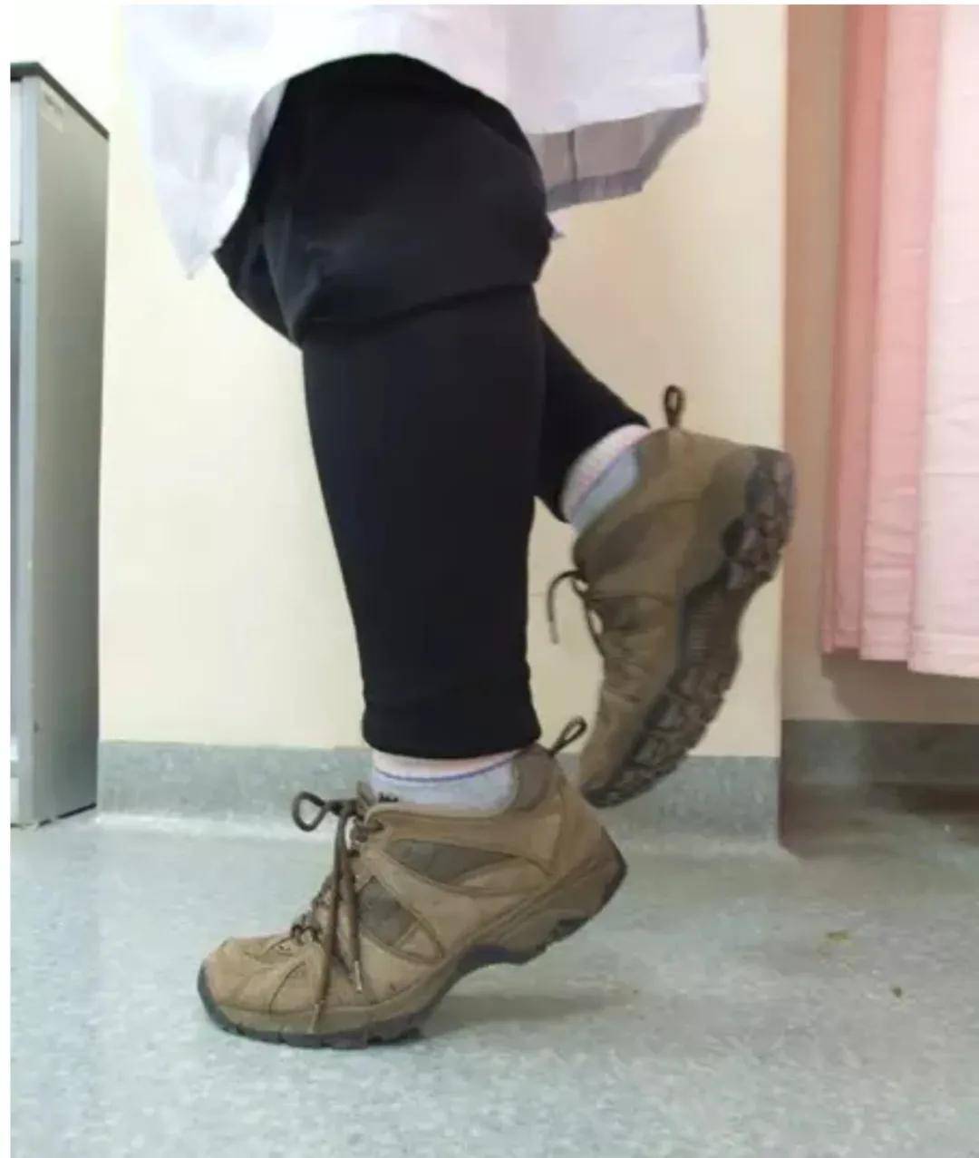 建议|虽然是小小损伤，也要注意康复！