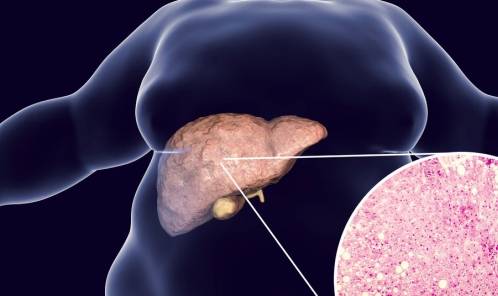 肝脏|肝脏变硬时，身体会有4个异常，一个没有，说明你的肝脏还算健康