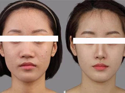 眼睛|什么样的长相特点会显“土味”？女明星都是怎样悄悄变精致的？