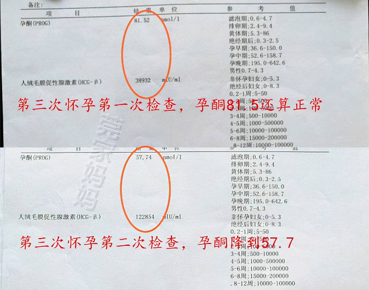 智商|盘点怀孕生娃时交过的“智商税”，希望你别中招，孕妈要“避坑”