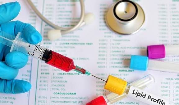 水平|血脂的正常范围是多少？这几个指标，你可别超了