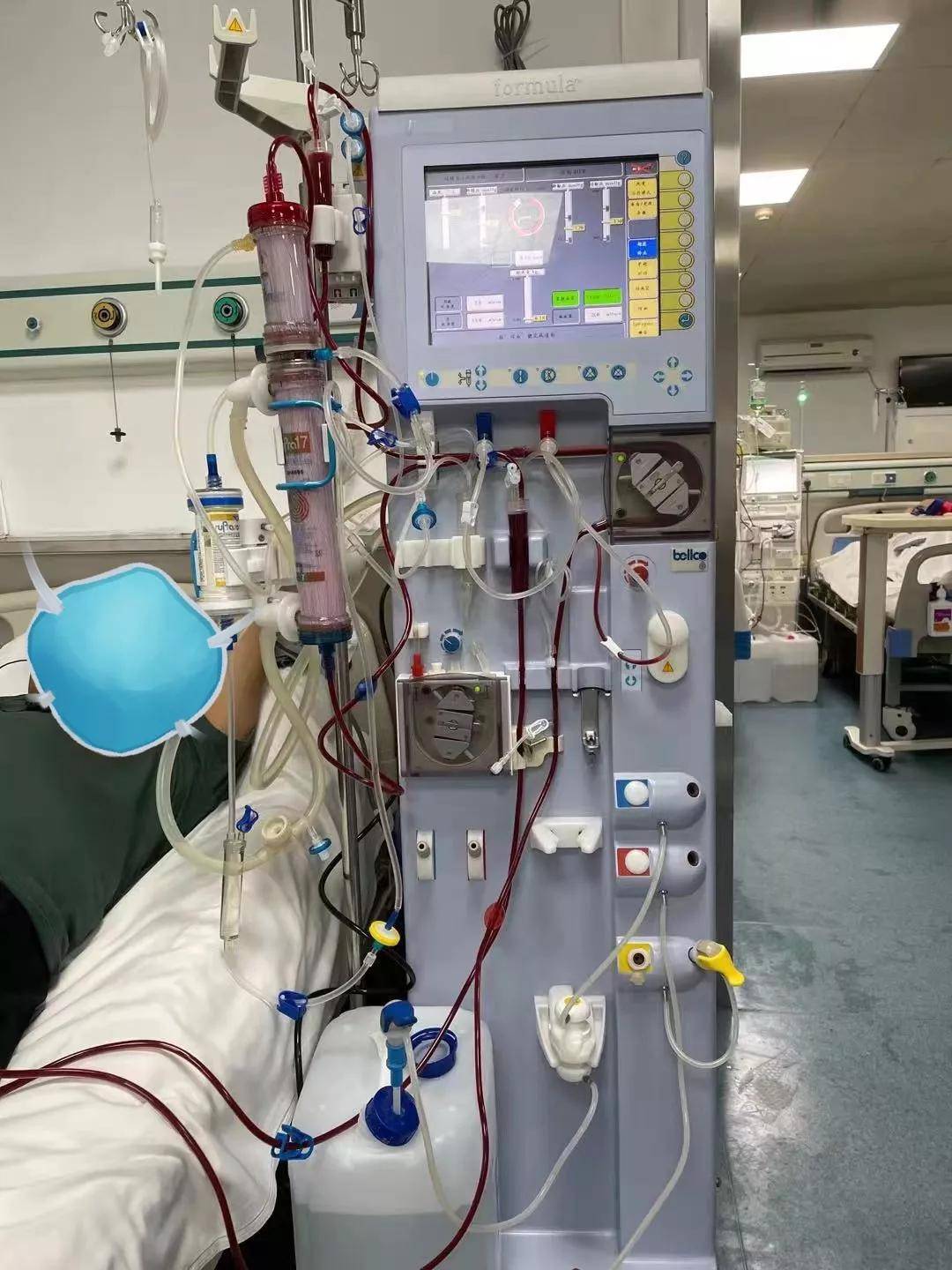 治疗|陕西首例|西安医学院一附院开展第三代血液净化新技术“血滤吸附SupraHFR”