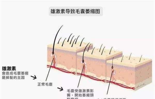 头皮|这三位女明星的发量可以排在娱乐圈前三了，妹子们羡慕吗？