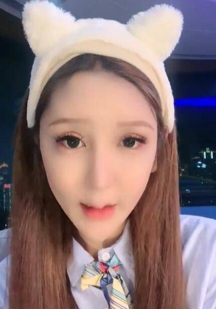 因为|女网红注射奥美定8年后爆发问题，额头内部溃烂，透露胸和屁股都曾注射奥美定