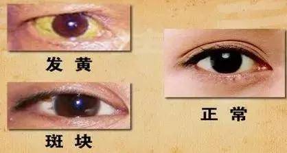 cd1f698efdae463981ce9f8f91ec0900.jpeg