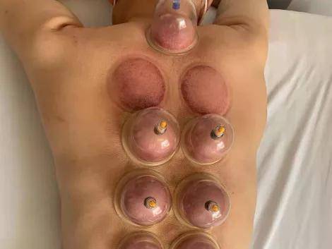 颜色|【护理科普】使用真空拔罐器居家自我保健的方法和误区