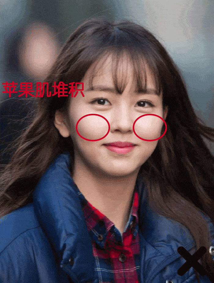 牙龈|有些人明明长得挺不错，但为什么笑起来不好看？