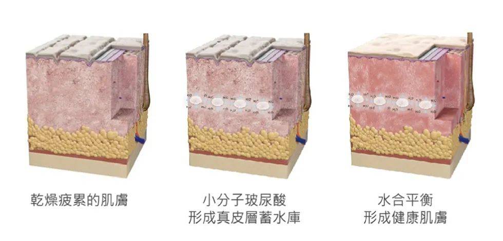 小逸|A醇精华哪家强？让一让，三重抗老王炸CP来咯！
