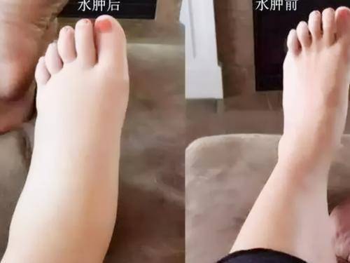 手脚|奚梦瑶自曝二胎的痛比一胎来得早，孕妈妈如何甩掉身体不适？