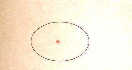 治疗|肝不好，多吃这4种食物，激活肝细胞，去除肝毒素，远离肝硬化