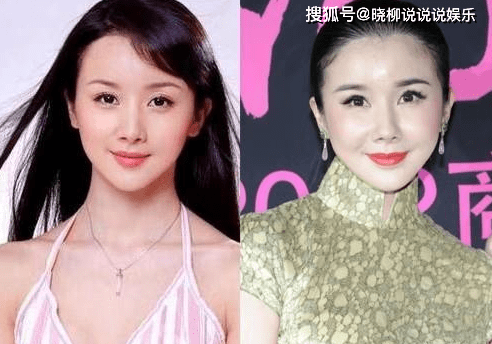 丑出|盘点娱乐圈中整容失败的明星，网友：“太吓人，丑出天际”