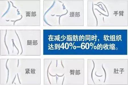 人群|黄金微雕、酷塑、美修斯、威塑 | 谁是下一个塑形之王？