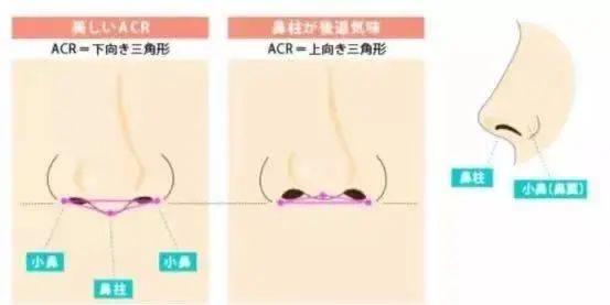 整形|权威！鼻部美学设计最全解析