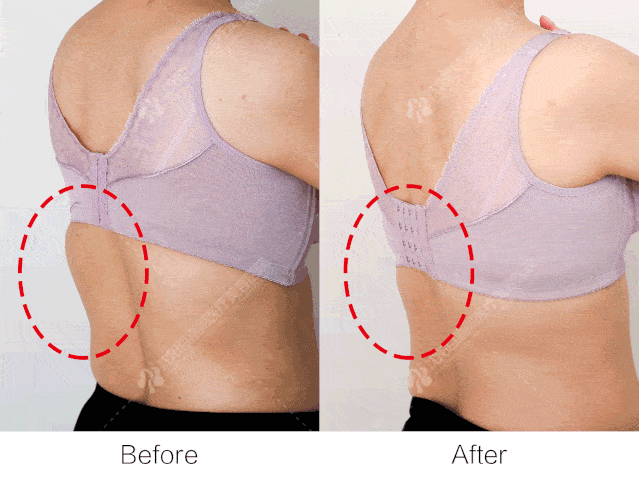 人群|黄金微雕、酷塑、美修斯、威塑 | 谁是下一个塑形之王?