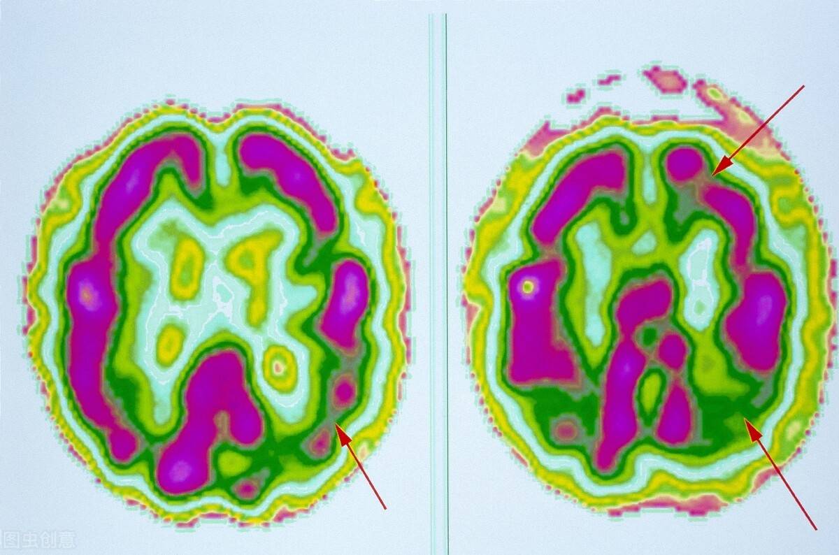 时间|喝茶能减少辐射吗？