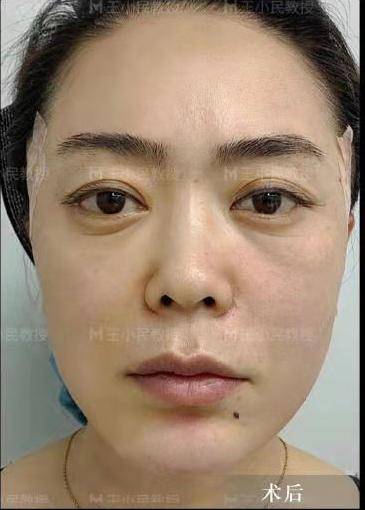 王小民|王小民教授：抹平岁月痕迹，你从来不知道你也可以这样美