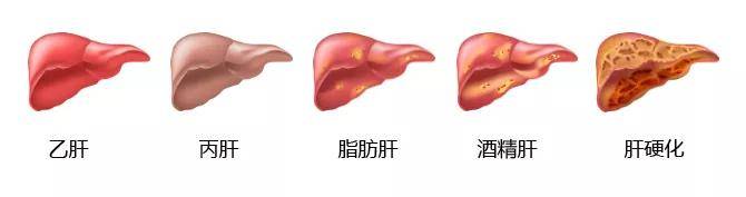 肝功能异常该怎么办