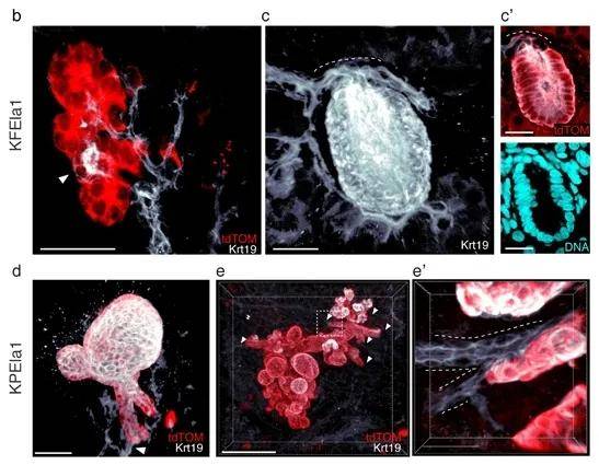 3D成像：肿瘤及病理组织中的应用