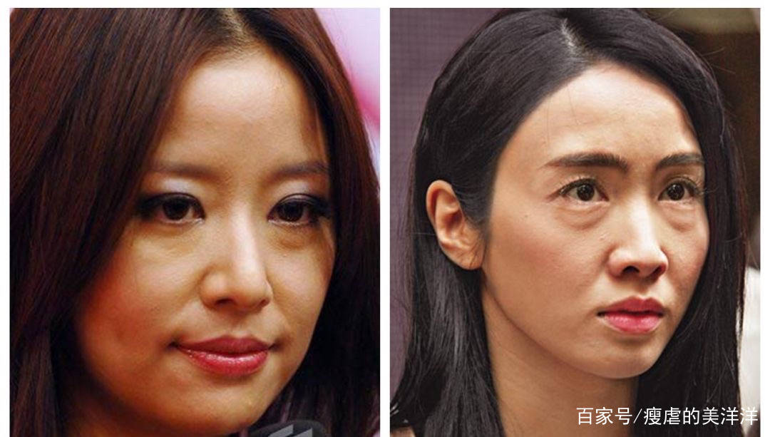眼睛|有眼袋，20岁的小仙女也会被拖累成老阿姨！
