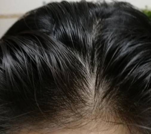头皮|洗发水并非贵效果才好，这4款洗发水人气高又好用，孕妈都整箱买