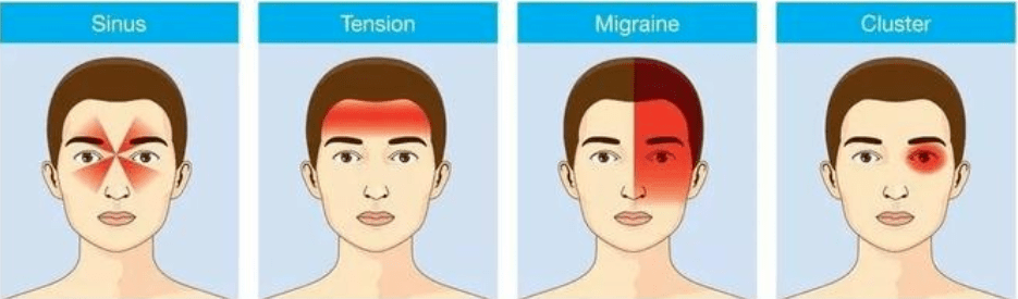 構成員小屋多様体妊娠超初期偏頭痛 Vintagecafe Jp