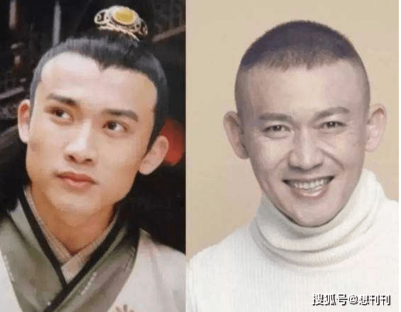 下巴|那些一刀切削骨的明星还好吗？后遗症一大堆，小方脸成最大赢家
