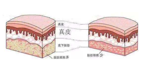 科普|韦元强科普：关于吸脂塑形，如何巧妙“避坑”？