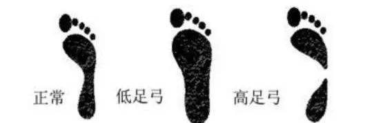 仙女|单品｜你的凉鞋该换了！今夏跪求你穿这3双！