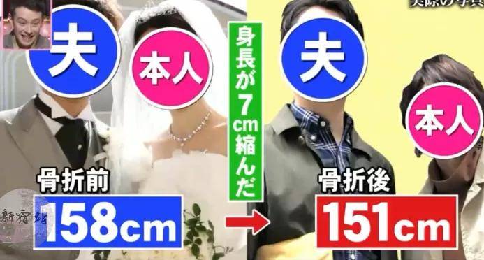 太阳|日本一妹子，不想被晒黑每天全副武装！2年后却发现自己矮了7cm....