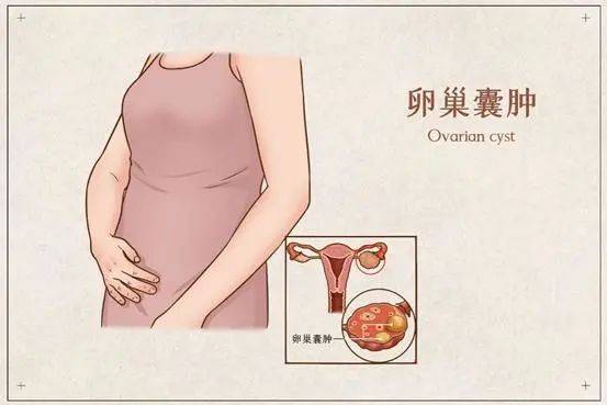什么症状说明正在排卵 133e1430f70d46729cc8950aa6ee3838.jpeg