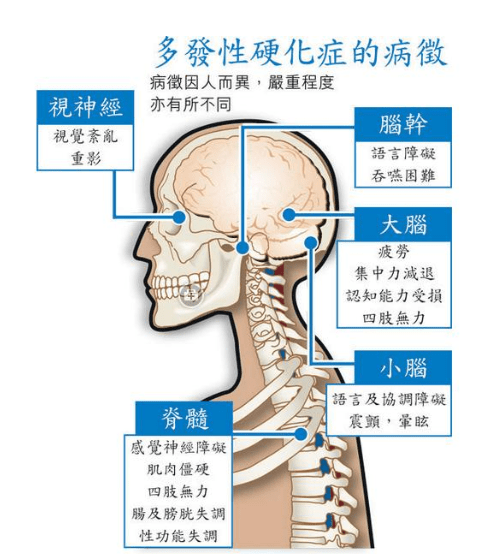 瑞妮葆|瑞妮葆芝麻素SVE:年轻人也要重视神经系统健康