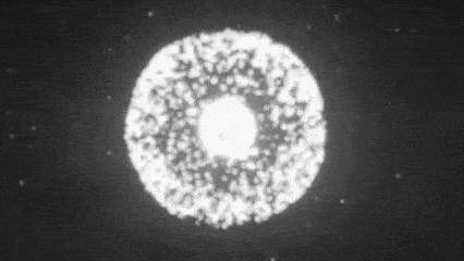 功能|干细胞是肺纤维化的“清道夫”，是肺损伤患者的福音