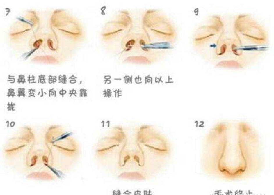 隆穹|太尴尬了！盘点8位明星“改头换面”后车祸现场，都是灾难（下）