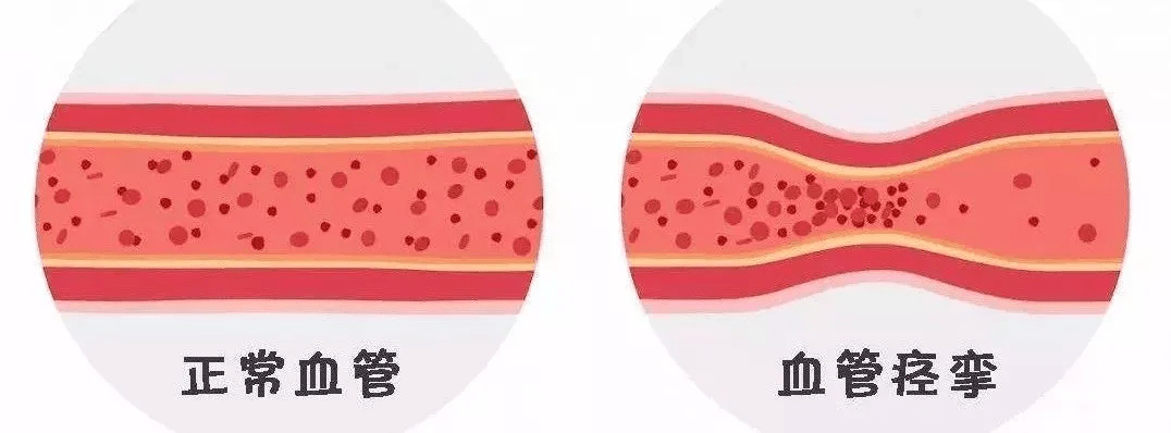 冠状动脉|“气死”是真的！72岁老太吵架进医院，很多病都跟情绪有很大关系