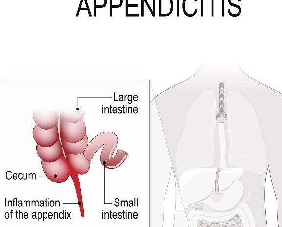 症状|如何在早期“拿住”大肠疾病,先弄懂五个知识