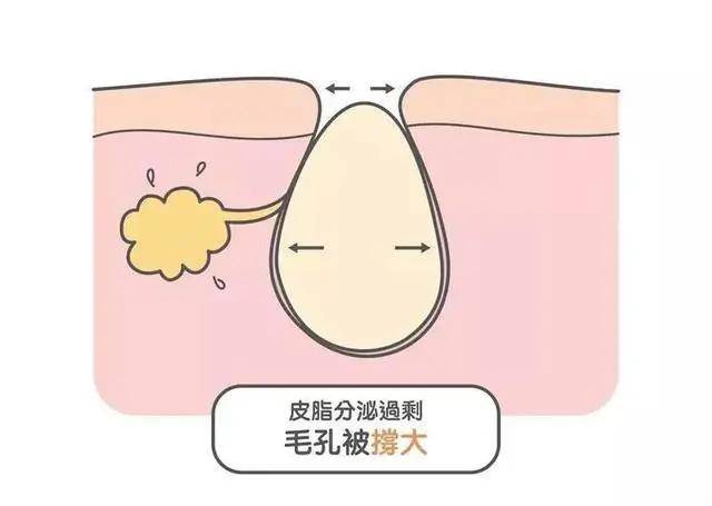 时间|混油皮和混干皮，你分的清么？