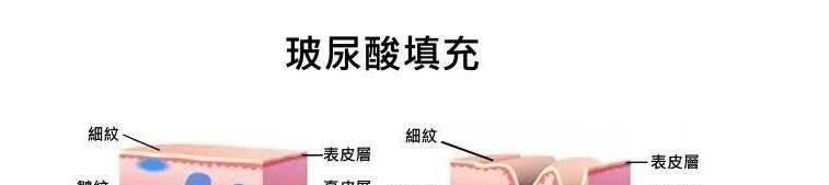玛吉|面部年轻化做得早，六十岁不显老！