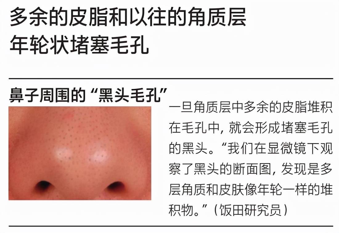 黑头|朱茵扎双丸子头超减龄 修饰毛孔为颜值加分