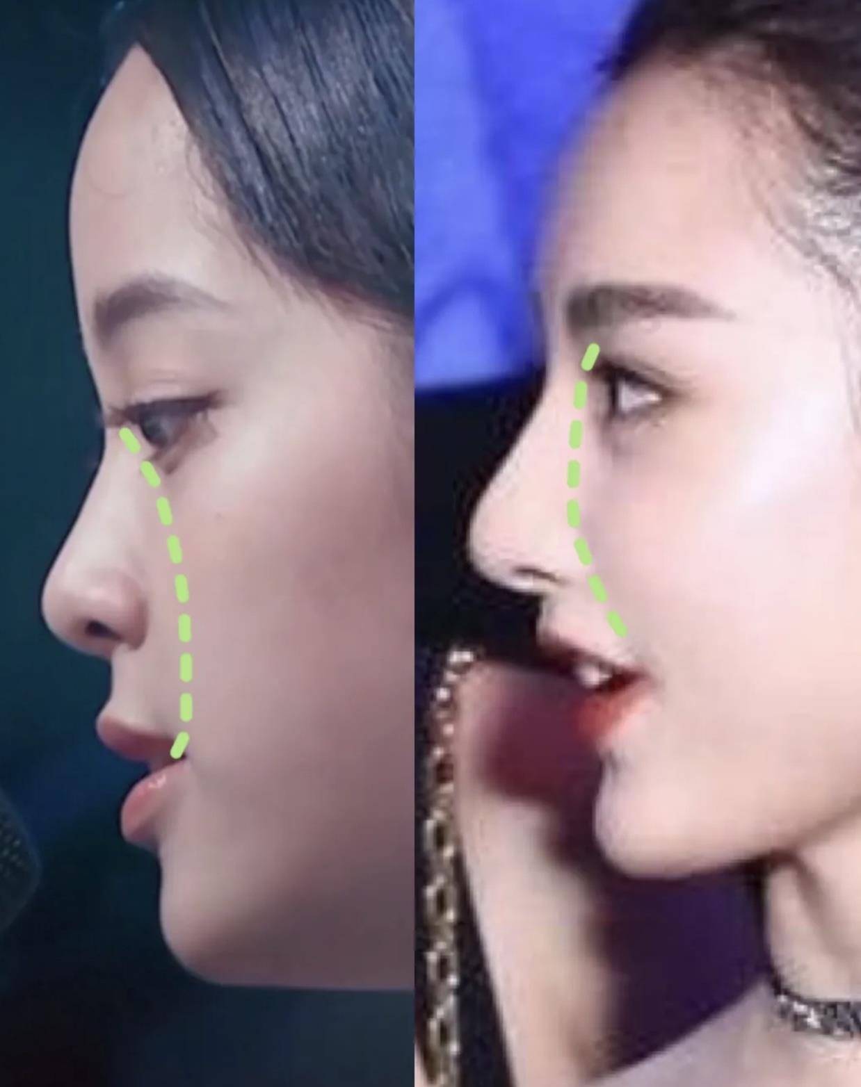 进行|欧阳娜娜的侧脸也太虐了吧？！论侧颜杀的重要性！