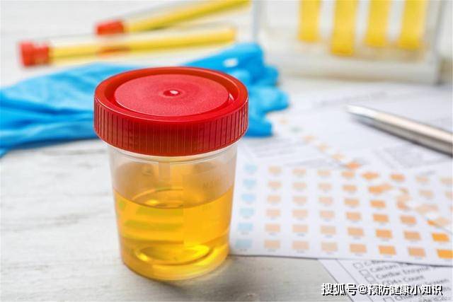 毒素|肝开始病变时，早上起床后，身体会“露出马脚”？不妨自查一下